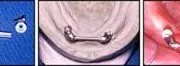 case 13