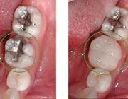 case 1b