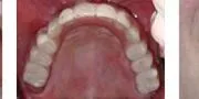 case 4b