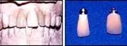 case 7