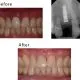 Case 10