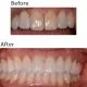Before After
