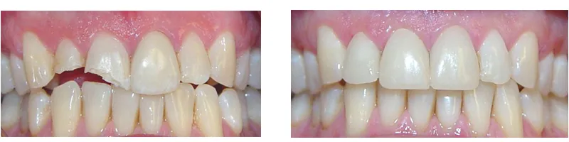 Case 5