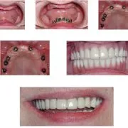 Case 7