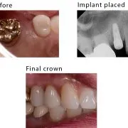 Case 8
