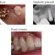 Case 8