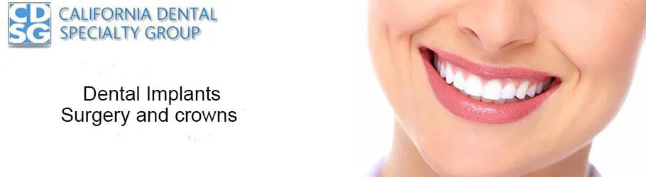 Dental Implants Surgery and crowns