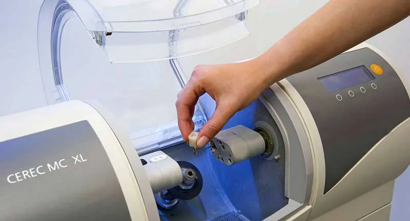 5-Things-You-Should-Know-About-CEREC-Crowns