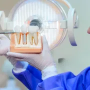 The Dental Implant Process